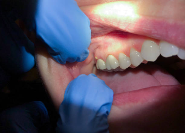 Fast & Reliable Emergency Dental Services in AR